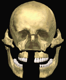 Animation of facial trauma